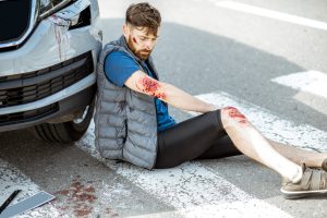 Injured man leaning against car with multiple and severe injuries that are bleeding.