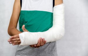 A child with a broken arm wearing a plaster cast that goes from his hand up past his elbow. 